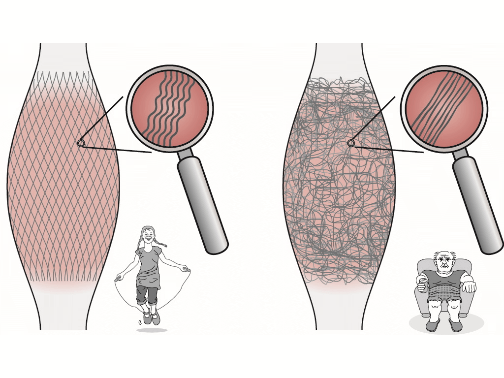 SISSEL Myofascia Ball